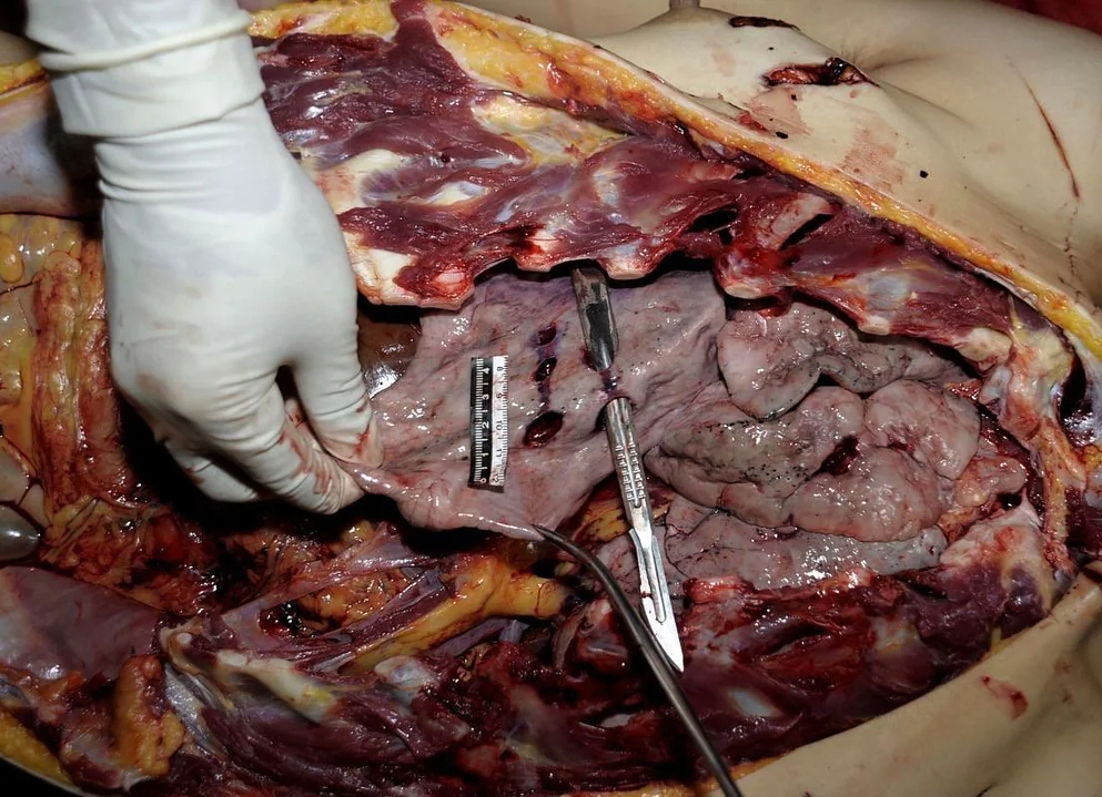 Woman stabbed to death with a partial autopsy at the scene