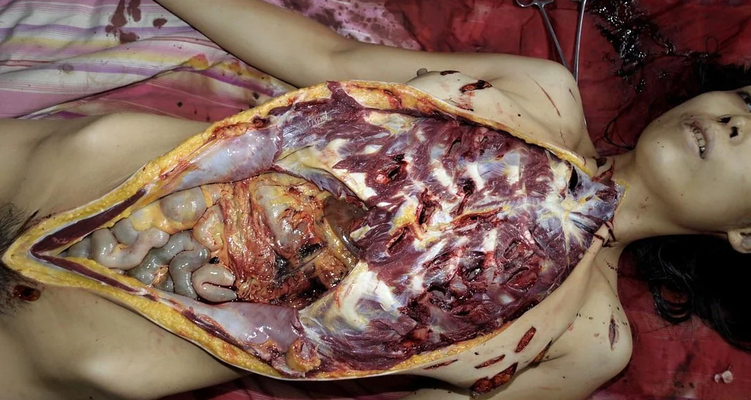 Woman stabbed to death with a partial autopsy at the scene