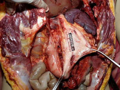 Woman stabbed to death with a partial autopsy at the scene