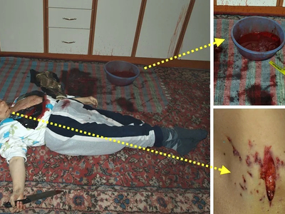 Suicide Short Compilation