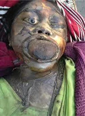 A mix of decaying corpses