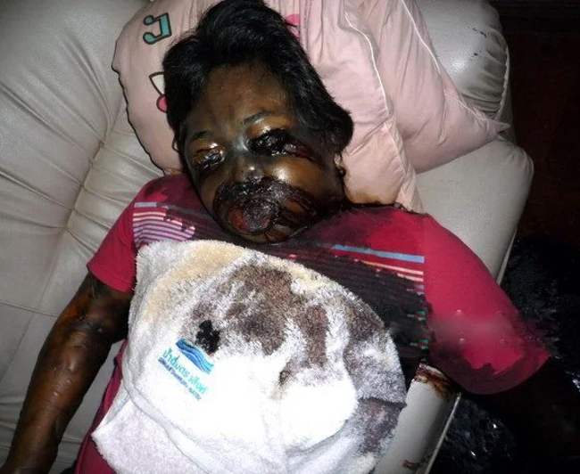 A mix of decaying corpses