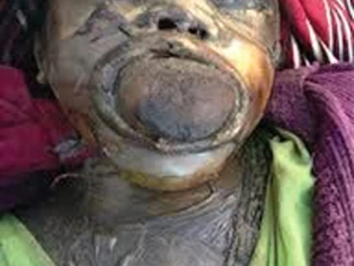 A mix of decaying corpses