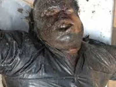 A mix of decaying corpses