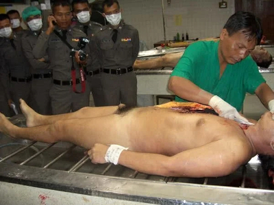 A collection of autopsies of various men