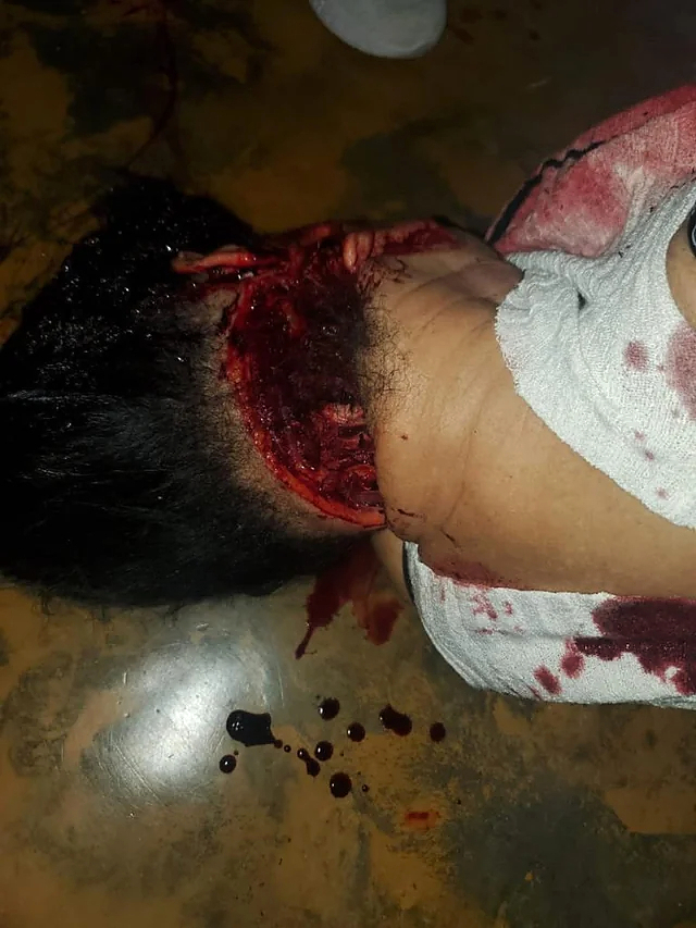 Man murders wife with machete, before hanging himself