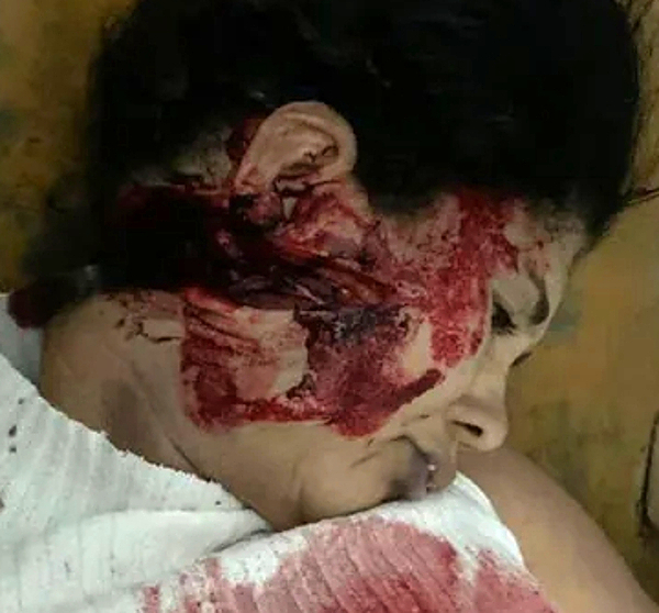 Man murders wife with machete, before hanging himself