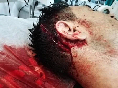 Romania: That's a brutal attack