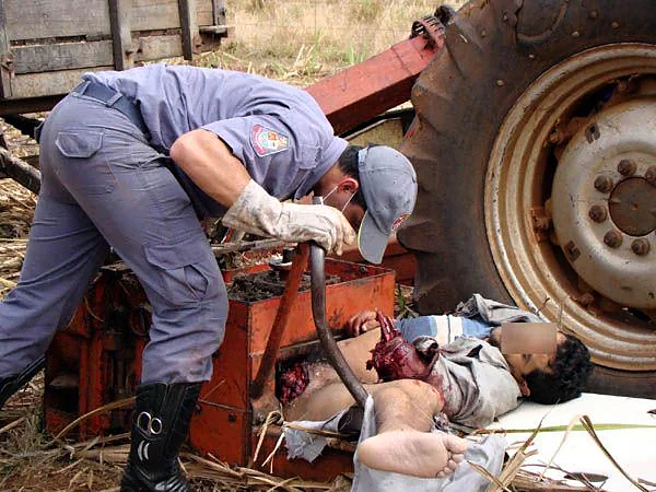 Sugarcane shredder accident