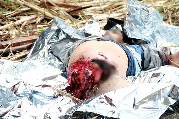 Sugarcane shredder accident