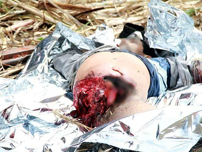 Sugarcane shredder accident