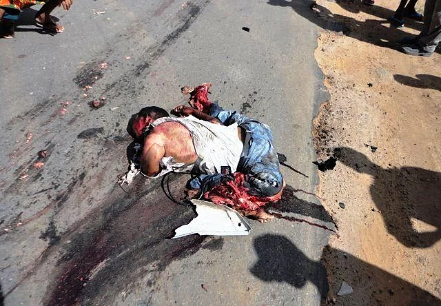 Man unfortunately hit by car and then by a truck