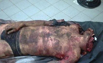 Man involved in horrific car accident