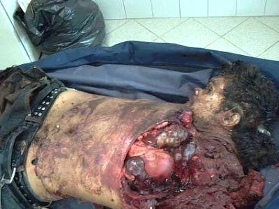 Man involved in horrific car accident