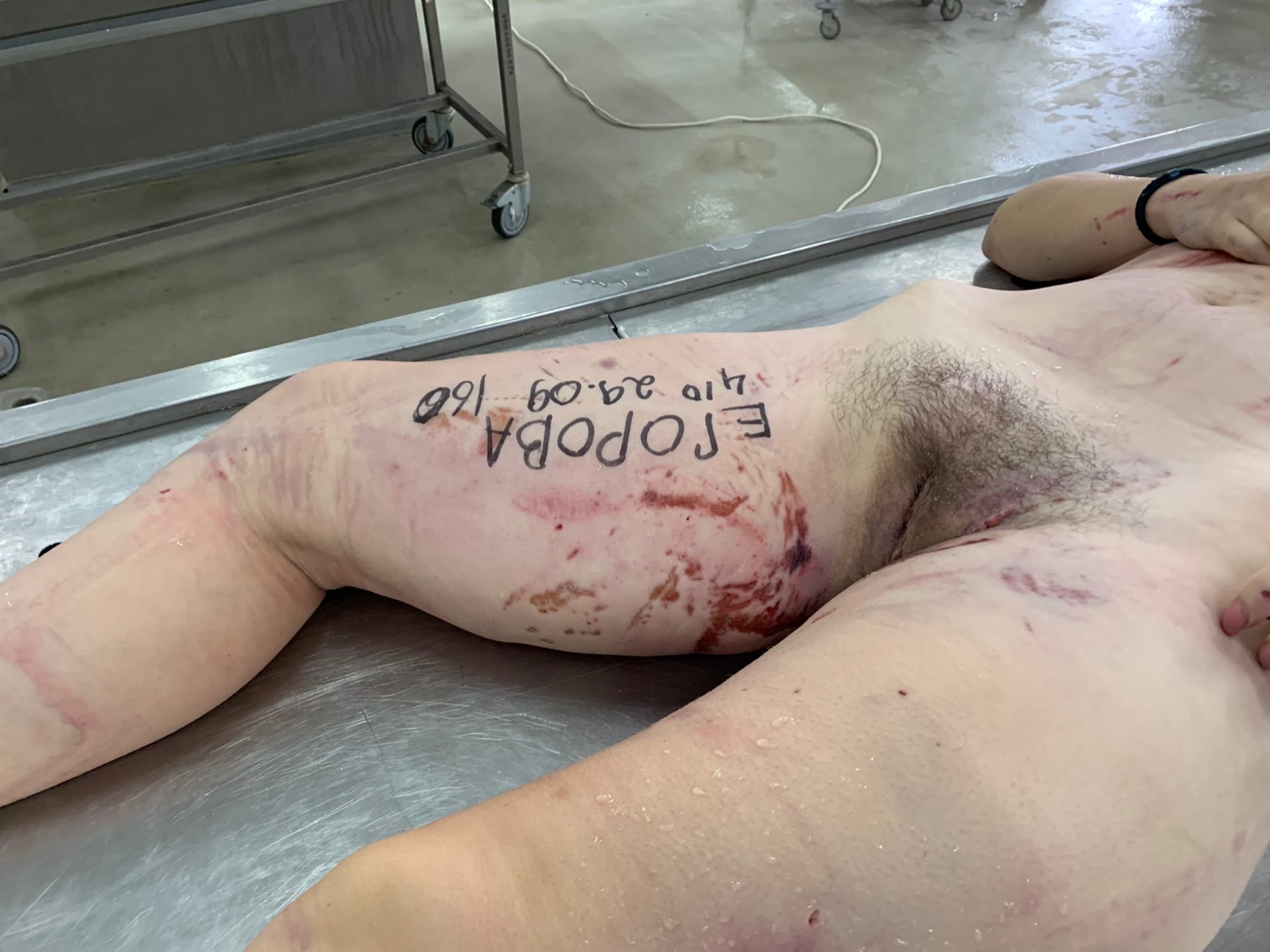 Dead young woman with cracked skull.