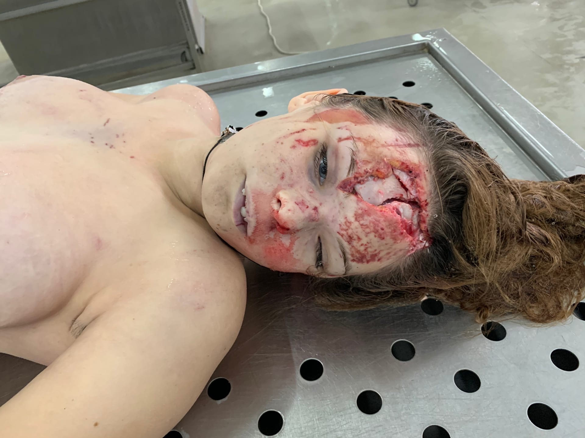 Dead young woman with cracked skull.