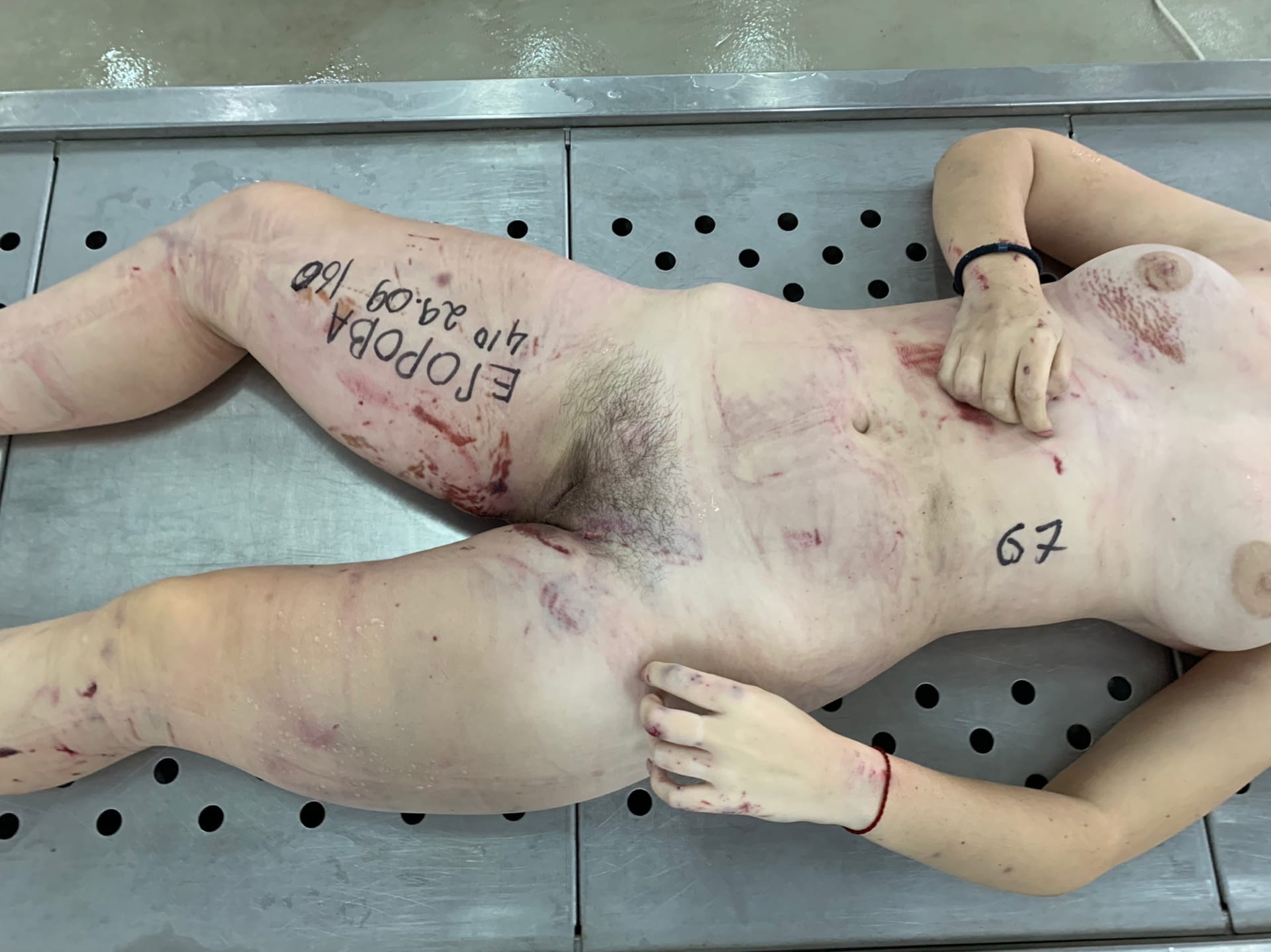 Dead young woman with cracked skull.