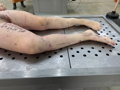 Young woman with cracked skull