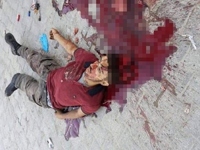 Turkish soldiers are not breathing in the pkk