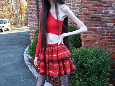 Eugenia Cooney anorexic 