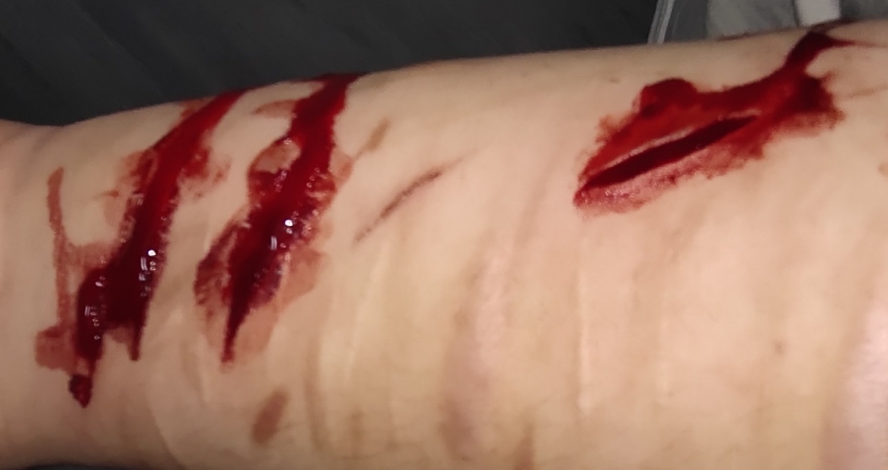 self harm