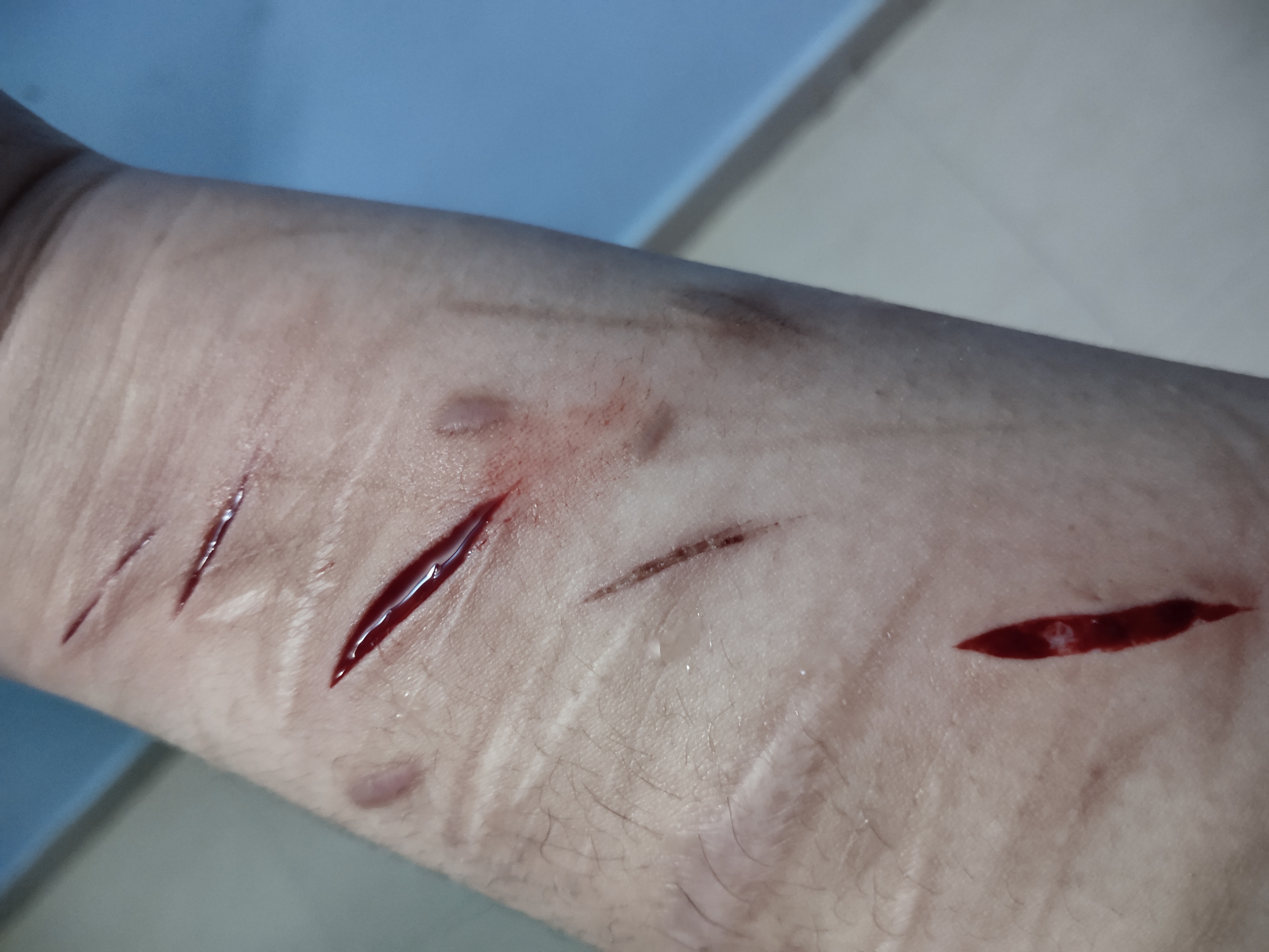 self harm