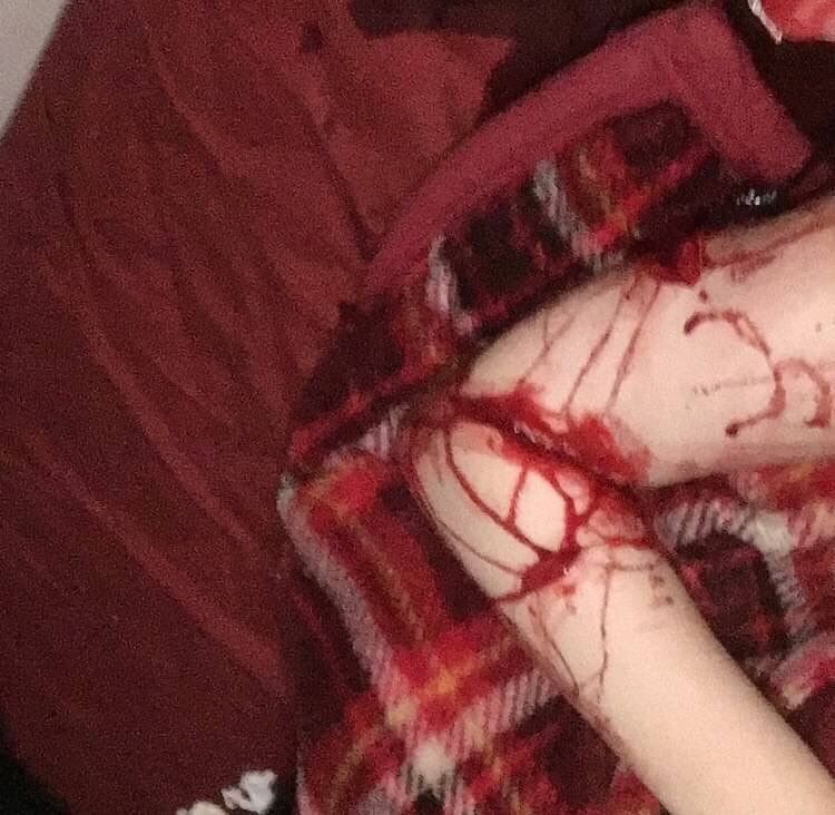 Depressed teenager bloody self harm