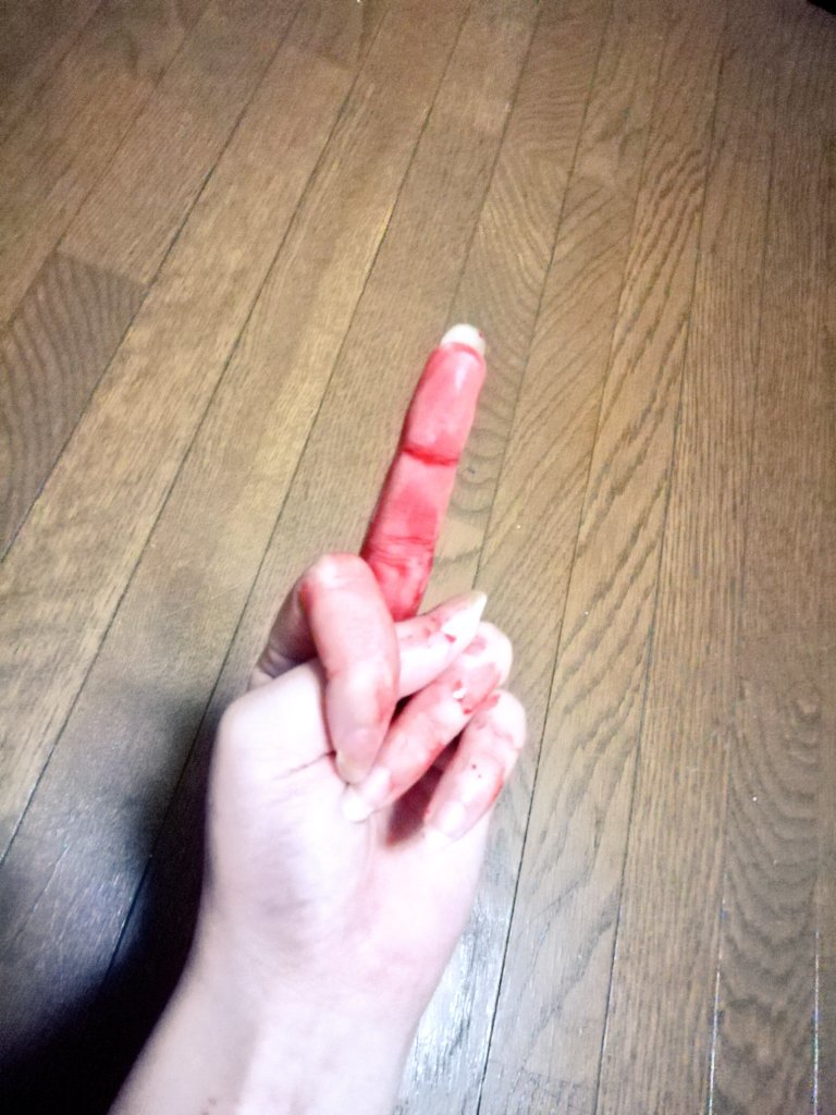 Depressed teenager bloody self harm