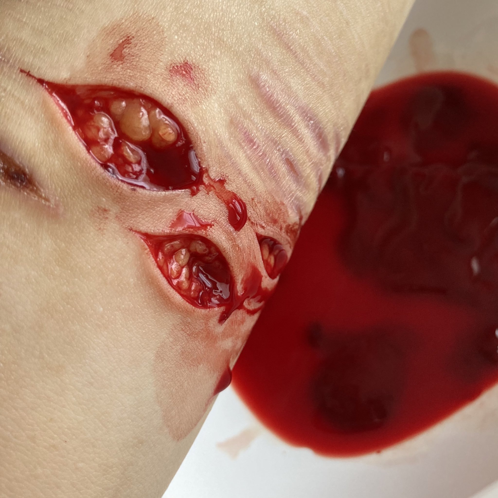 Depressed teenager bloody self harm