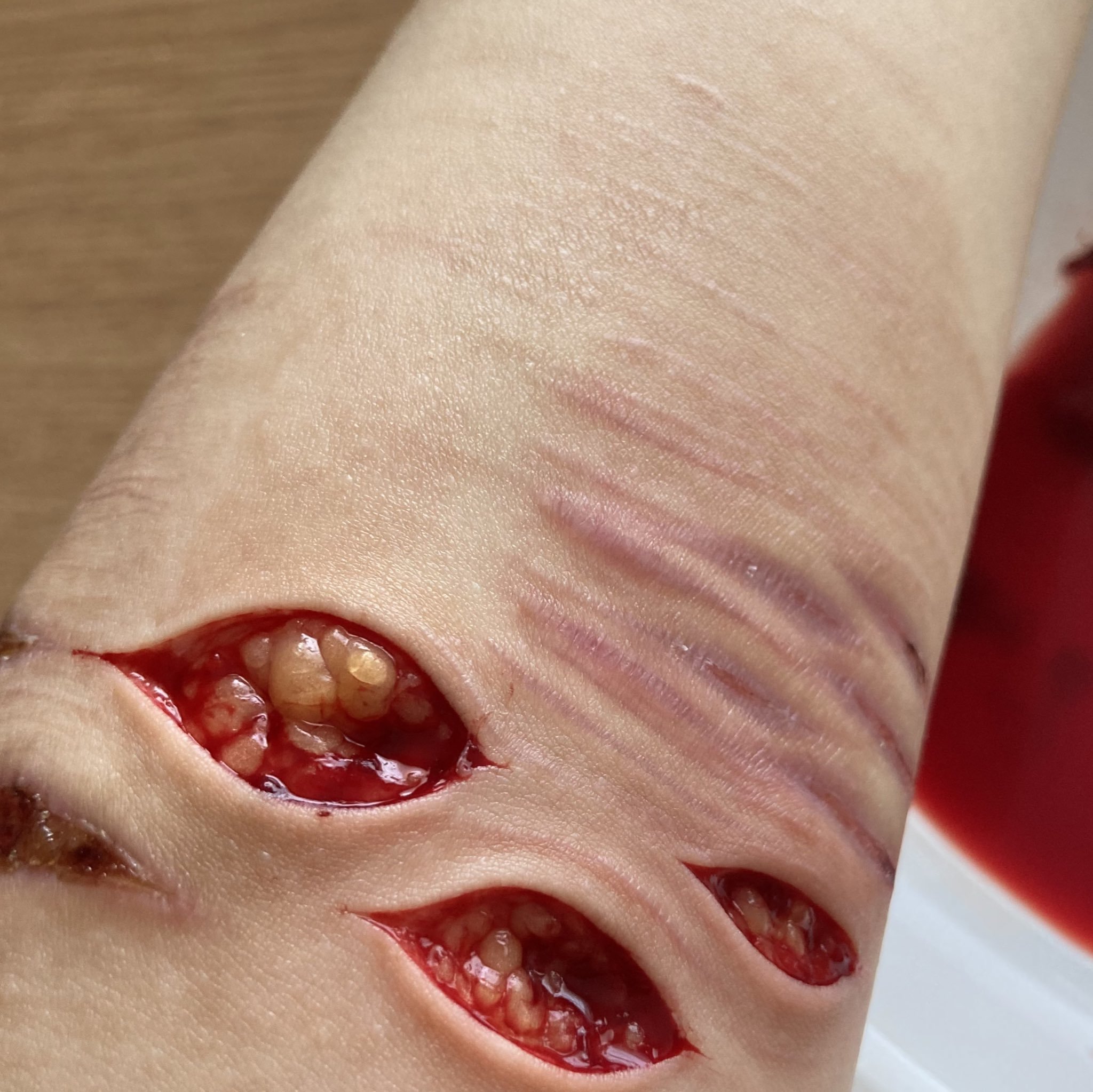 Depressed teenager bloody self harm