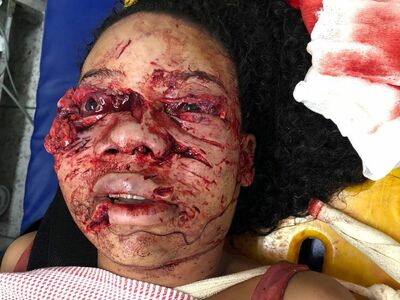 Pitbull Rips Owner's Face off