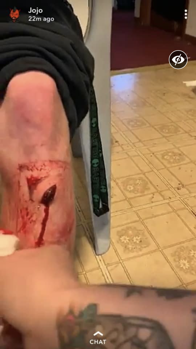 Steel Bicycle Pedal are Shin killers (PHOTOS)