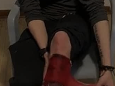 Steel Bicycle Pedal are Shin killers (PHOTOS)