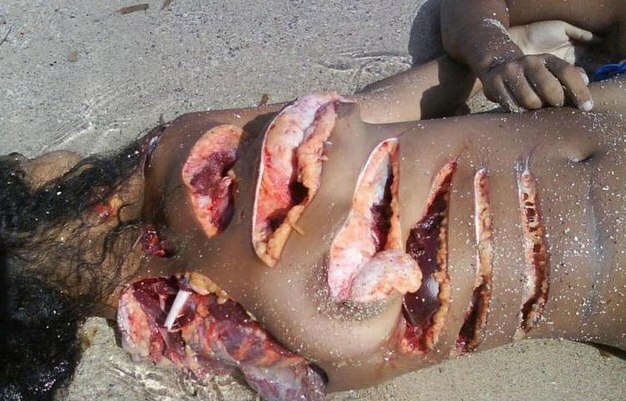 Brutal accident on the beach