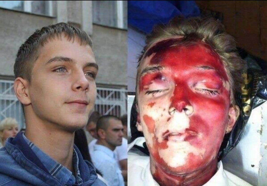 Uncensored Images of the Odessa Massacre
