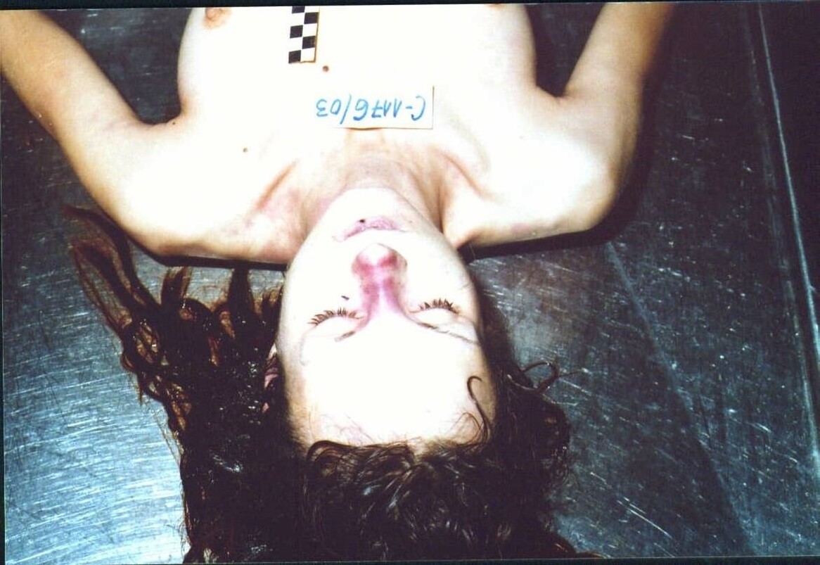 Woman Facial Dissection