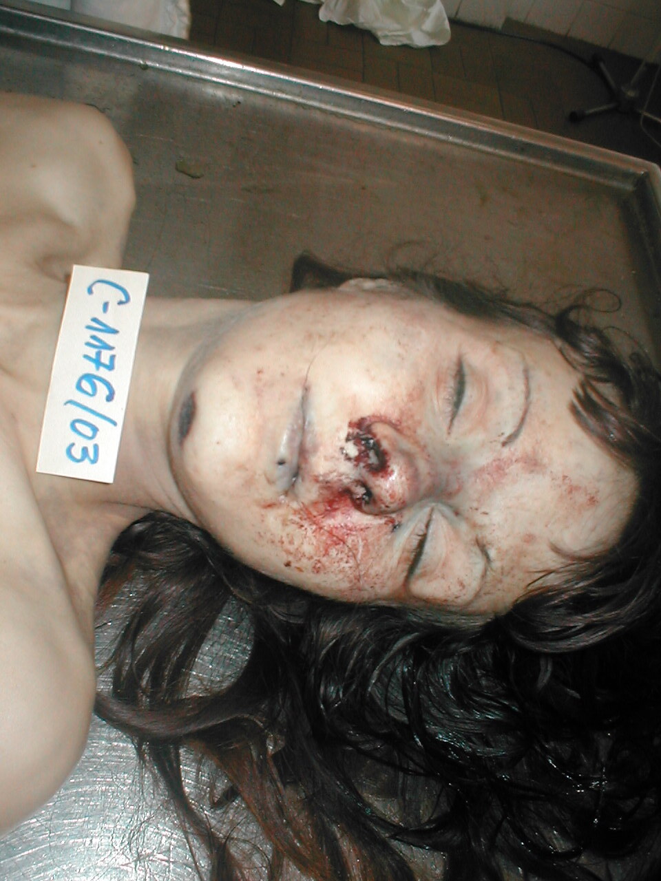 Woman Facial Dissection