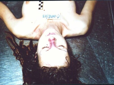 Woman Facial Dissection