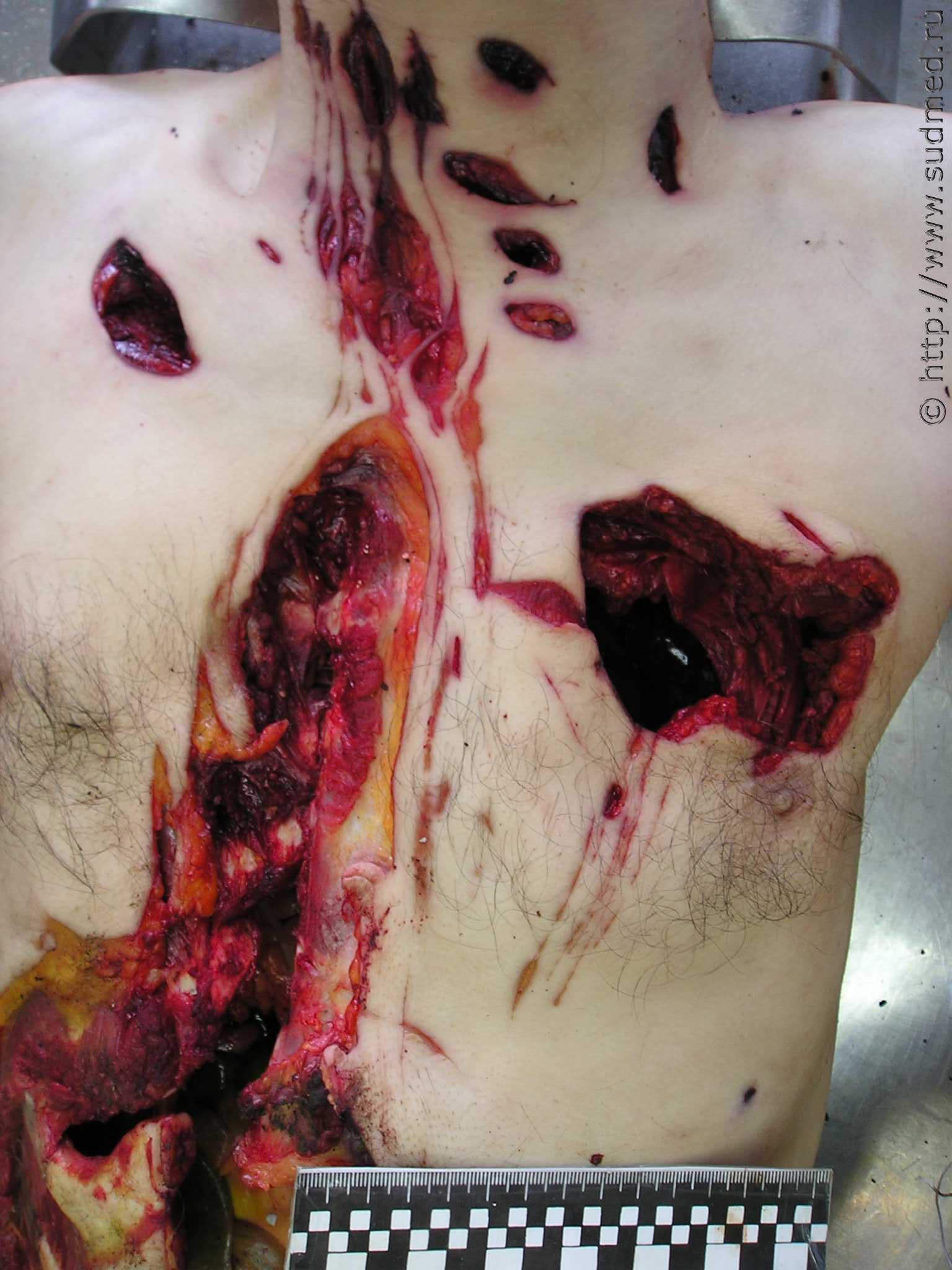 SICKENING: The Russian Cannibal's Leftovers