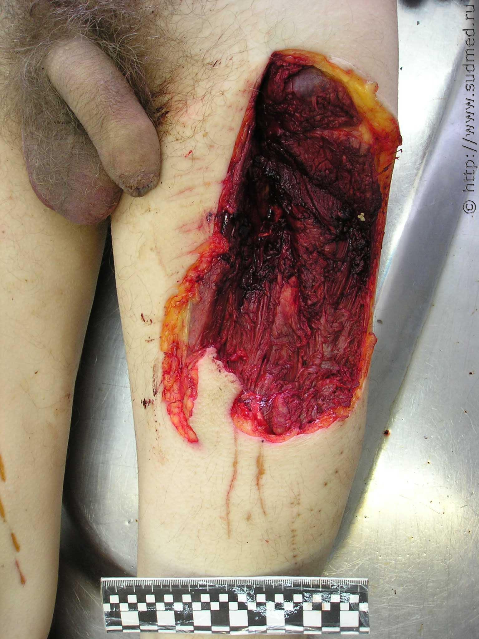 SICKENING: The Russian Cannibal's Leftovers