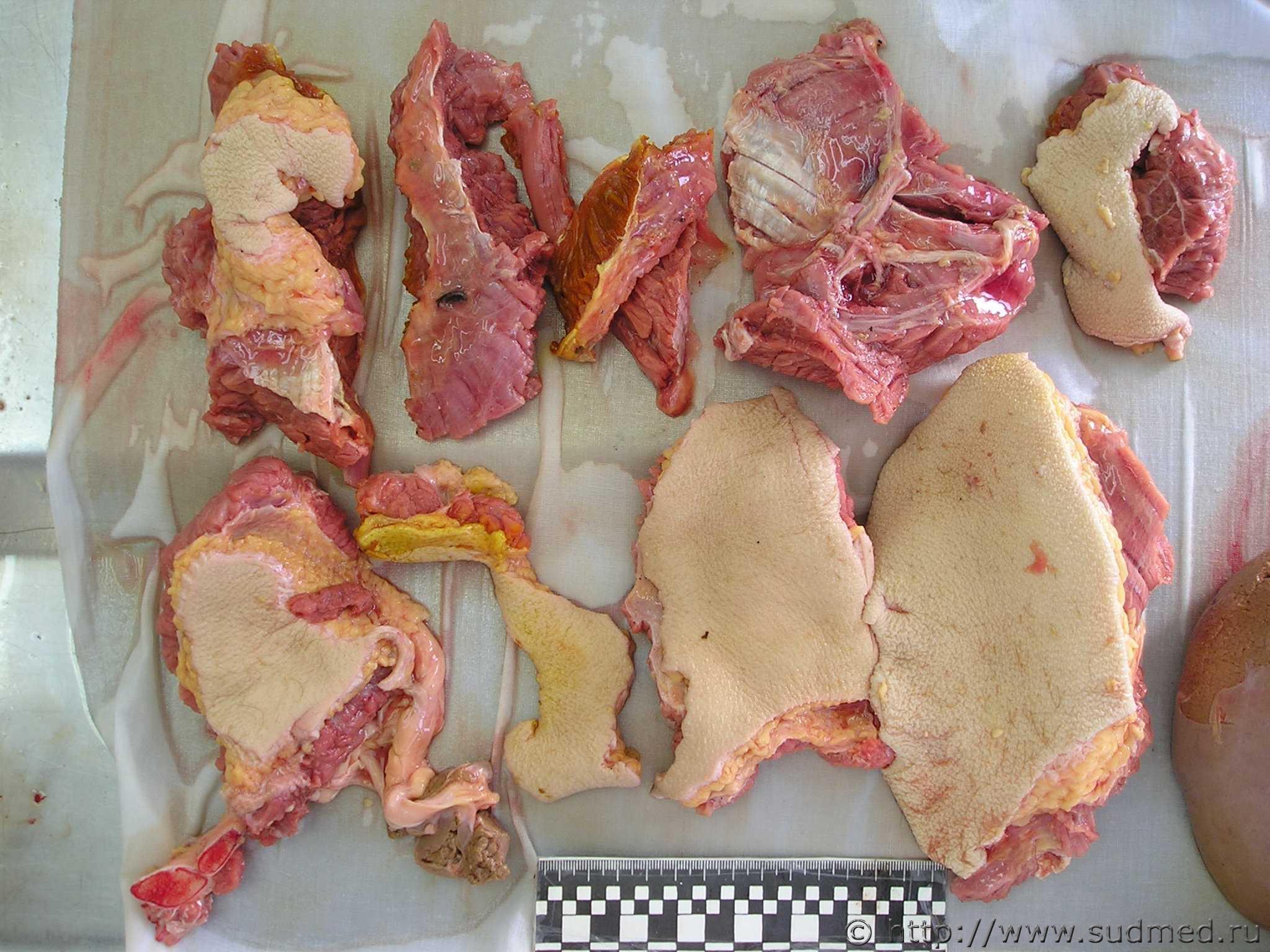 SICKENING: The Russian Cannibal's Leftovers