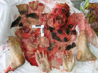 Russian Alcoholic Dismembers Another Alcoholics Head