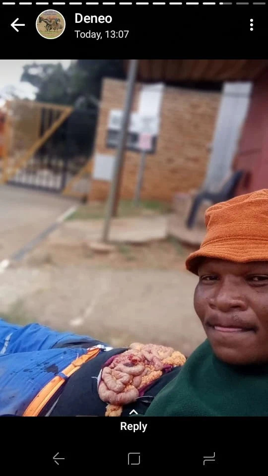 Here are all the Photos of the Dude that Stabbed Friend.