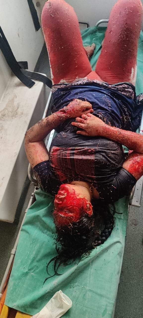 INDIA: BEAUTIFUL WOMAN STABBED BY HUSBAND.