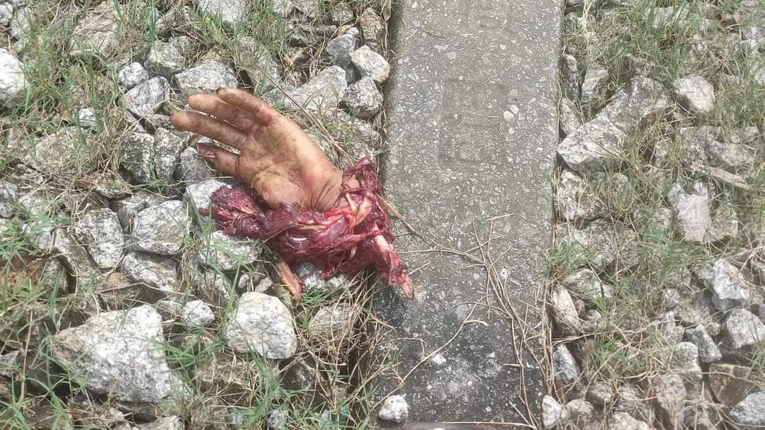 He Tried To Outrun The Train