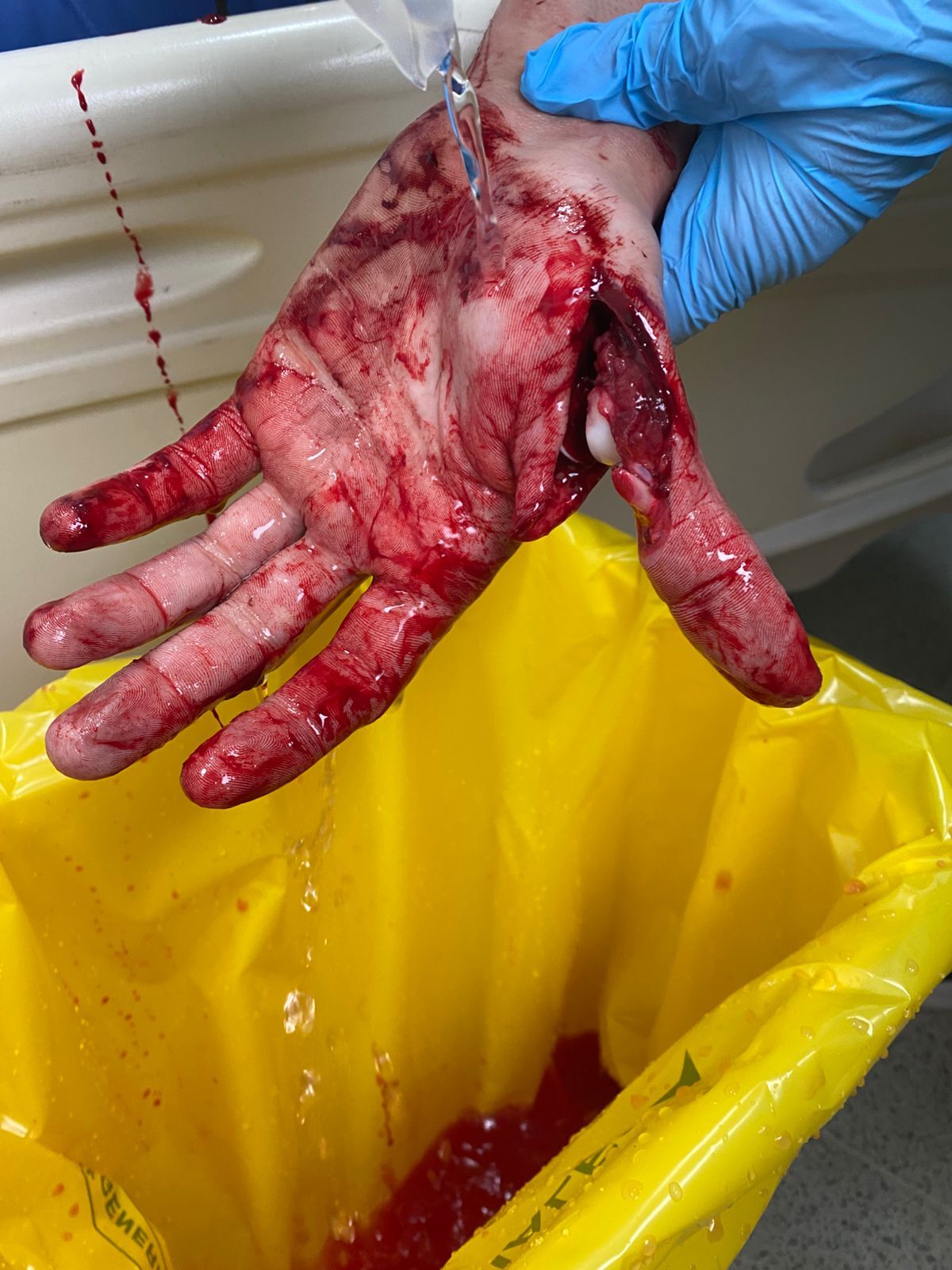 Colleague in processing plant attacks with butcher's knife