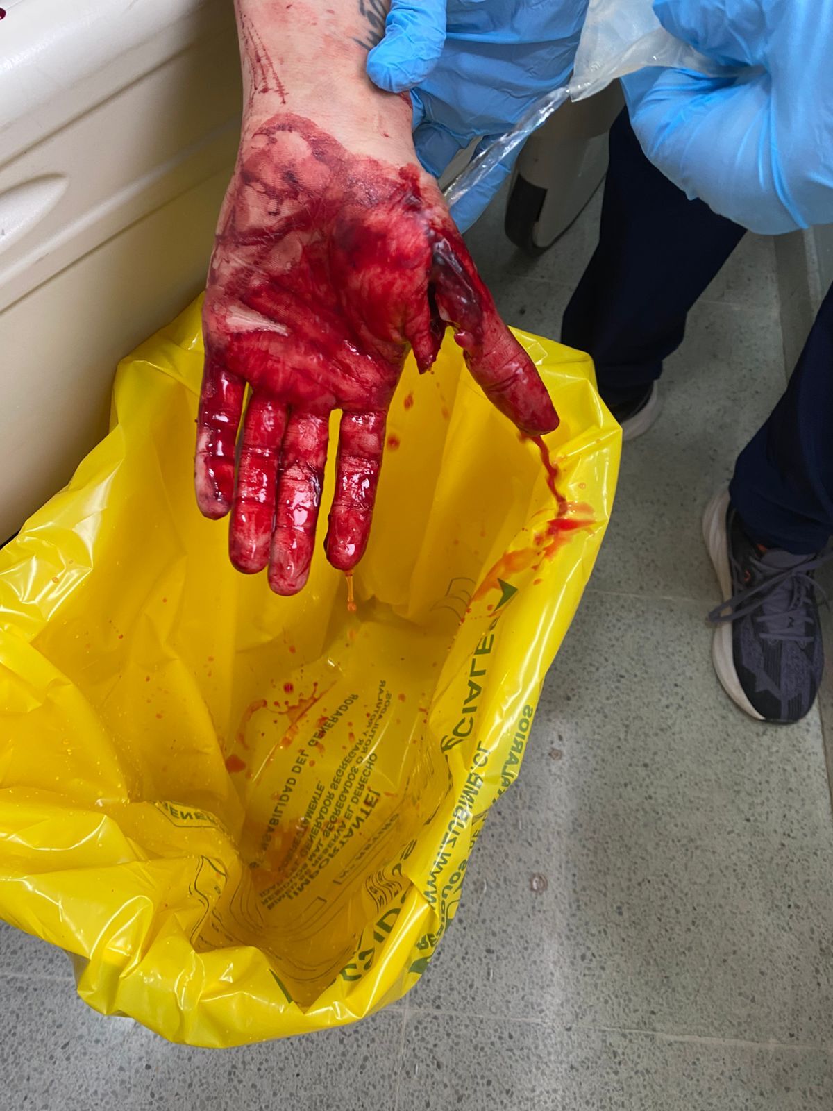 Colleague in processing plant attacks with butcher's knife