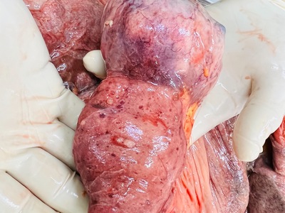 Autopsy, necrotic tissue