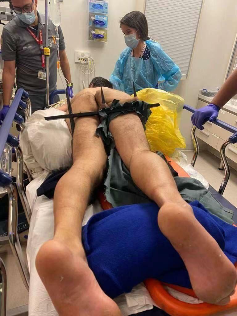 Balls Impaled on railings.