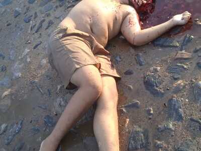 Face blown off by gunshots